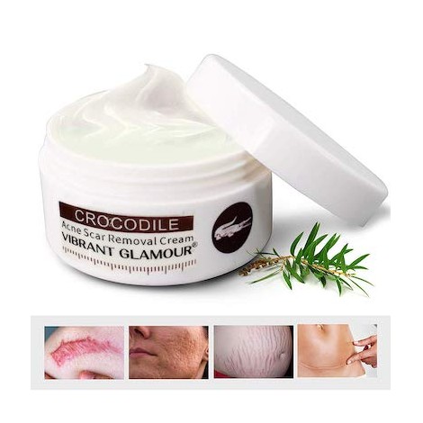 Scar Removal Cream For Old Scars